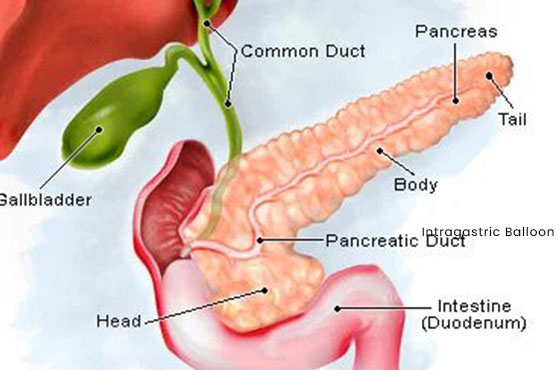 Pancreatic Cyst Treatment in Dubai - Dr Kaiser Raja in Kings College ...