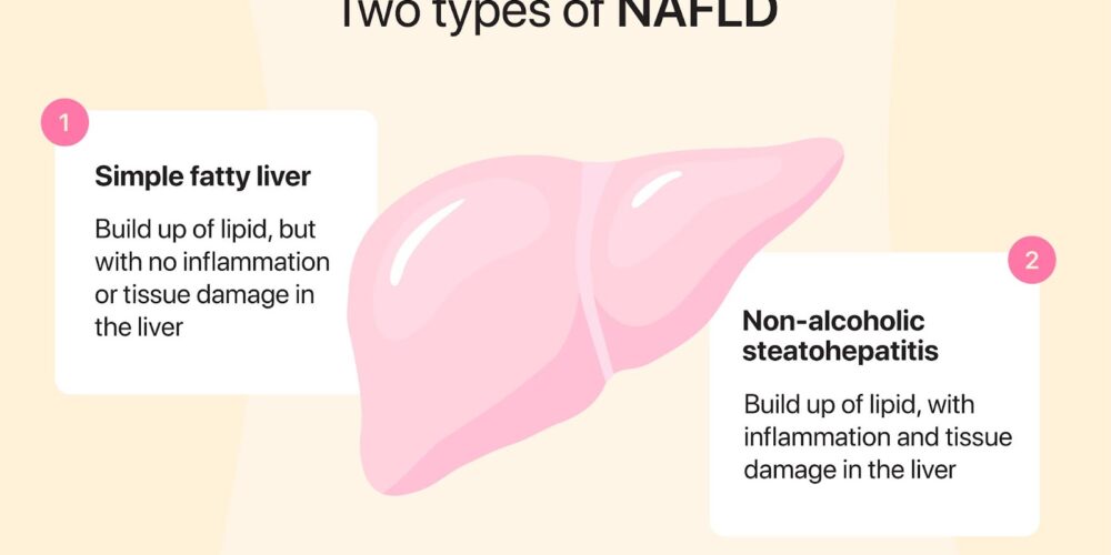 Types of fatty liver