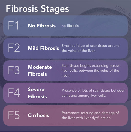 how-does-fibroscan-measure-liver-stiffness-dr-kaiser-raja