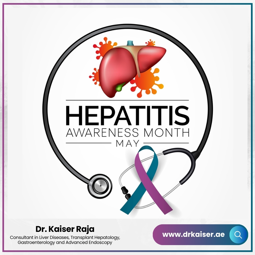 Hepatitis Awareness Month May 2024 Dr Kaiser Raja in Kings College